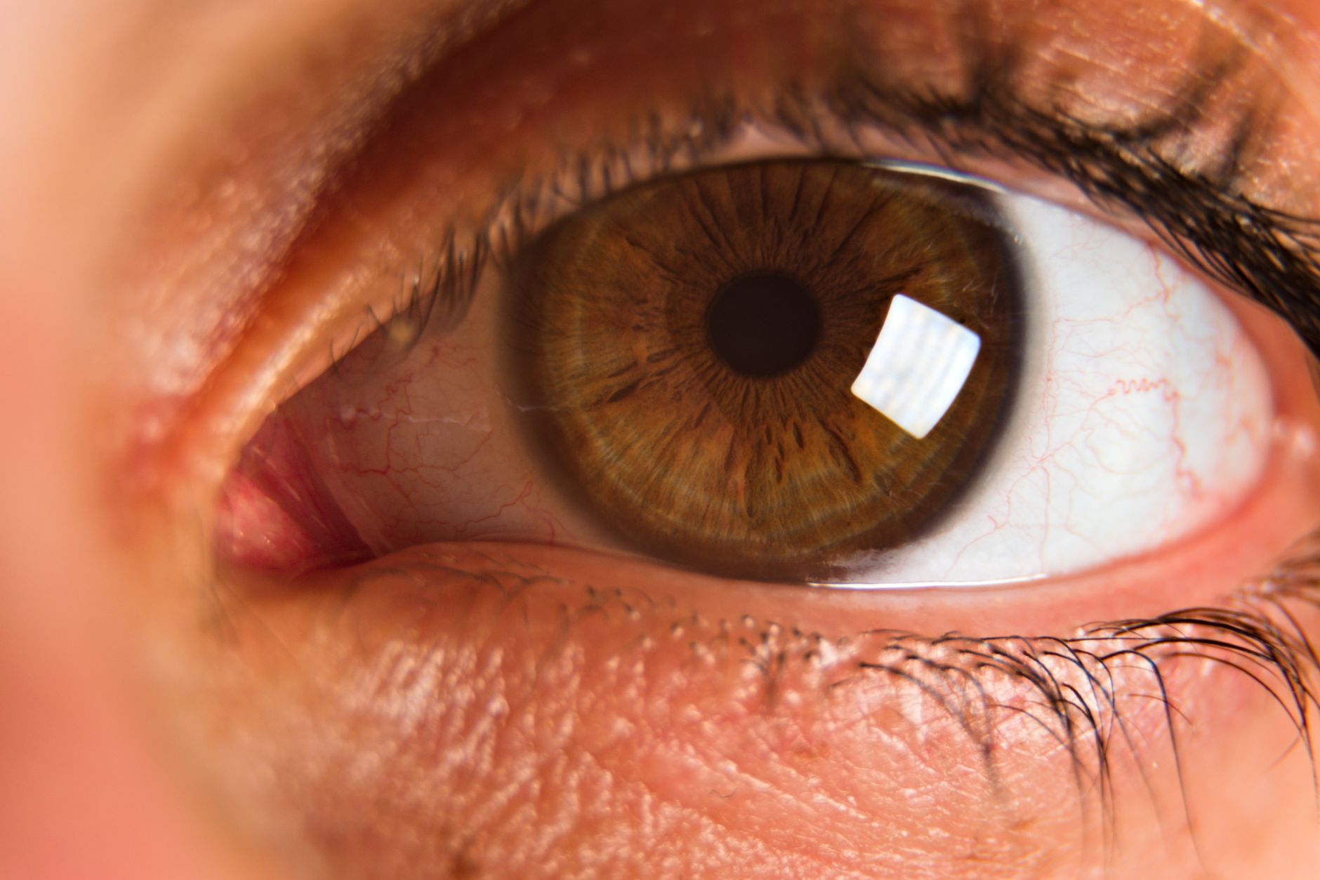 BALL: the eyeball